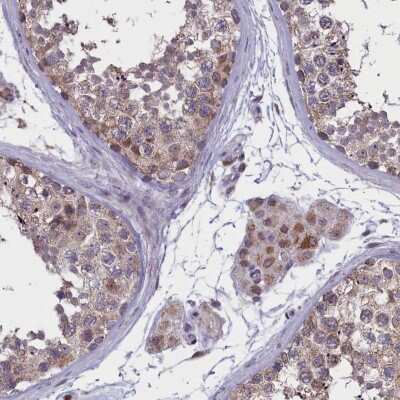 Immunohistochemistry-Paraffin: PARS2 Antibody [NBP2-33912]