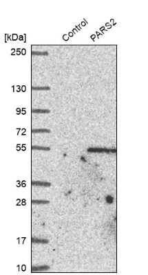 Western Blot: PARS2 Antibody [NBP1-84105]