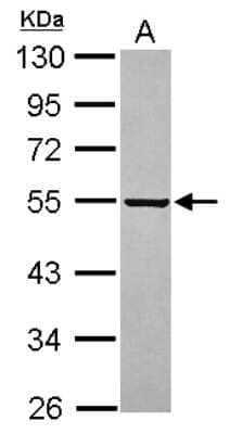 Western Blot: PARS2 Antibody [NBP2-19702]