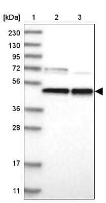 Western Blot: PARS2 Antibody [NBP2-33912]