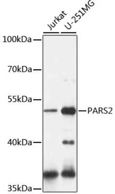 Western Blot: PARS2 AntibodyAzide and BSA Free [NBP2-94594]