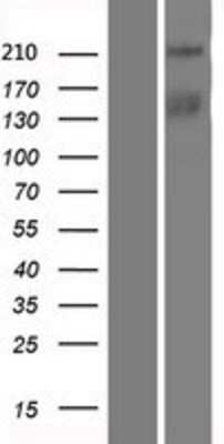 Western Blot: TICRR Overexpression Lysate [NBP2-05414]