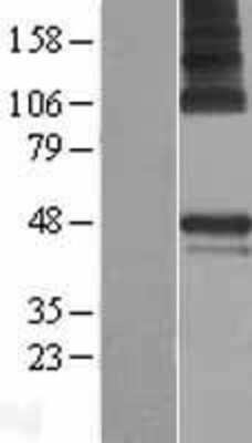 Western Blot: PARS2 Overexpression Lysate [NBP2-05415]