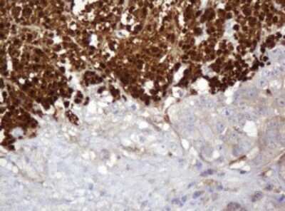 Immunohistochemistry: PARVB Antibody (OTI1B7) [NBP2-46327]