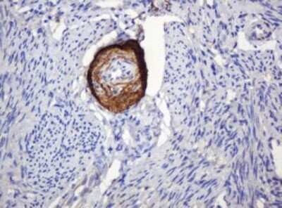 Immunohistochemistry: PARVB Antibody (OTI1B7) [NBP2-46327]