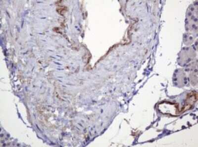 Immunohistochemistry: PARVB Antibody (OTI1B7) [NBP2-46327]