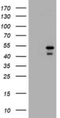 Western Blot: PARVB Antibody (OTI1B7) [NBP2-46327]