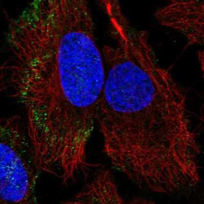 Immunocytochemistry/ Immunofluorescence: PARVB Antibody [NBP2-57479]