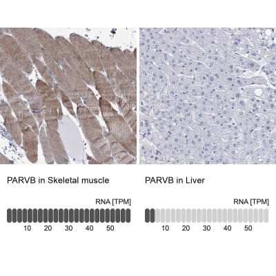 Immunocytochemistry/ Immunofluorescence: PARVB Antibody [NBP3-17063]