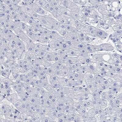 Immunohistochemistry-Paraffin: PARVB Antibody [NBP3-17063]