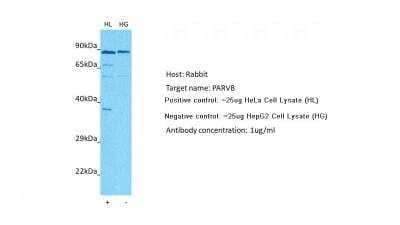 Western Blot: PARVB Antibody [NBP1-59129]