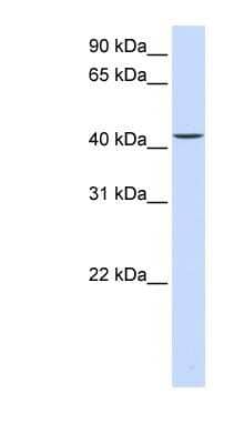 Western Blot: PARVB Antibody [NBP1-59135]