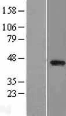 Western Blot: PARVB Overexpression Lysate [NBL1-14121]