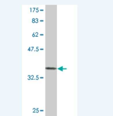 Western Blot: PASD1 Antibody (1F5) [H00139135-M07]