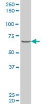 Western Blot: PASD1 Antibody (1G12) [H00139135-M06]