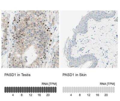 Immunohistochemistry-Paraffin: PASD1 Antibody [NBP1-84346]