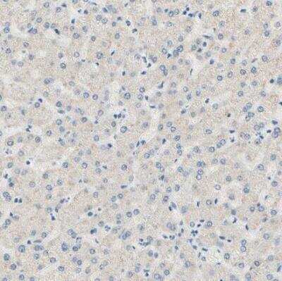 Immunohistochemistry-Paraffin: PASD1 Antibody [NBP1-84346]
