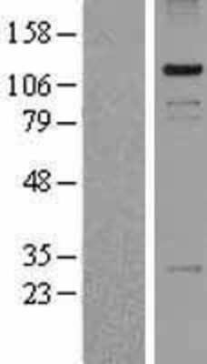 Western Blot: PASD1 Overexpression Lysate [NBP2-04435]