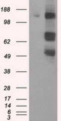 Western Blot: PASK Antibody (OTI8G9) [NBP2-02242]