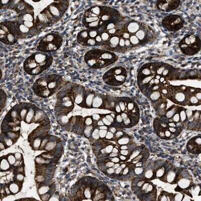 Immunohistochemistry-Paraffin: PASK Antibody [NBP1-83037]