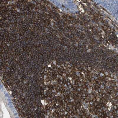 Immunohistochemistry-Paraffin: PASK Antibody [NBP1-83038]