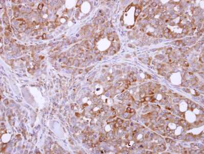 Immunohistochemistry-Paraffin: PASK Antibody [NBP2-19704]
