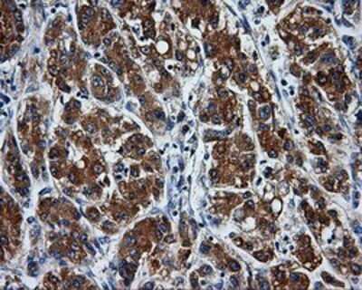 Immunohistochemistry: PASK Antibody (OTI8G9) - Azide and BSA Free [NBP2-73249]