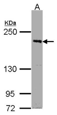 Western Blot: PASK Antibody [NBP1-32648]