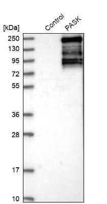 Western Blot: PASK Antibody [NBP1-83037]