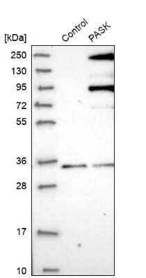 Western Blot: PASK Antibody [NBP1-83038]