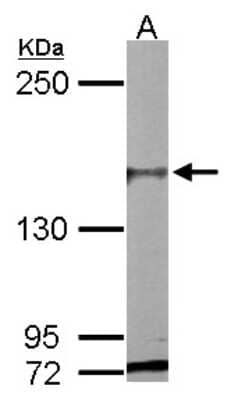 Western Blot: PASK Antibody [NBP2-19704]