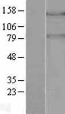 Western Blot: PASK Overexpression Lysate [NBL1-14124]