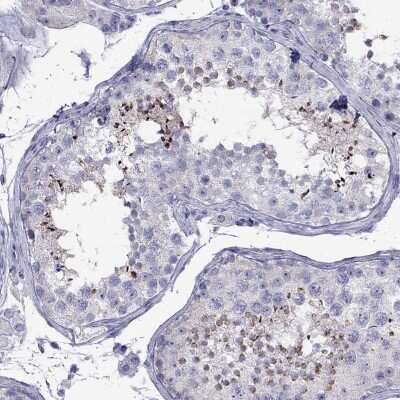 Immunohistochemistry: PATE Antibody [NBP2-69021]