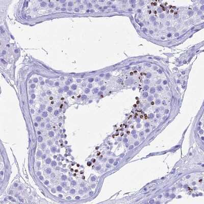 Immunohistochemistry-Paraffin: PATE4 Antibody [NBP1-93774]