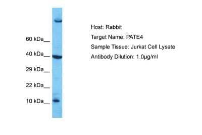 Western Blot: PATE4 Antibody [NBP2-83365]