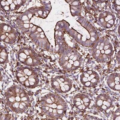 Immunohistochemistry: PATJ Antibody [NBP2-49481]