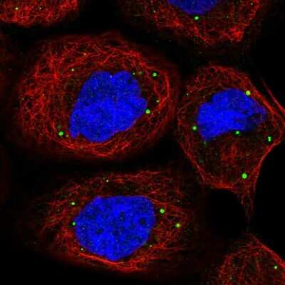 Immunocytochemistry/ Immunofluorescence: PATL1 Antibody [NBP1-93808]