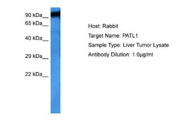 Western Blot: PATL1 Antibody [NBP2-83366]