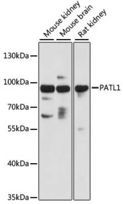 Western Blot: PATL1 AntibodyAzide and BSA Free [NBP2-93589]