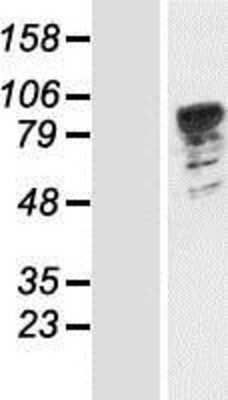 Western Blot: PATL1 Overexpression Lysate [NBP2-05320]