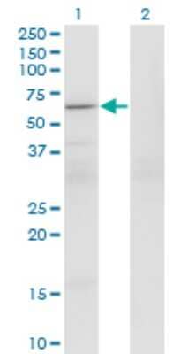 Western Blot: PATZ Antibody (1B2) [H00023598-M01]