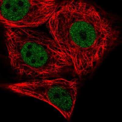 Immunocytochemistry/ Immunofluorescence: PATZ Antibody [NBP2-48884]