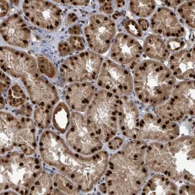 Immunohistochemistry: PATZ Antibody [NBP2-48884]