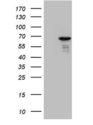 Western Blot: PATZ Antibody (OTI8D6)Azide and BSA Free [NBP2-73256]