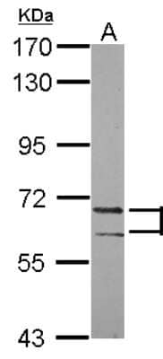 Western Blot: PATZ Antibody [NBP2-19708]