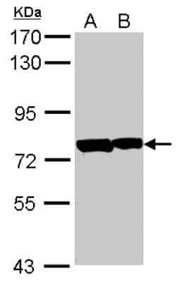 Western Blot: PATZ Antibody [NBP2-19709]