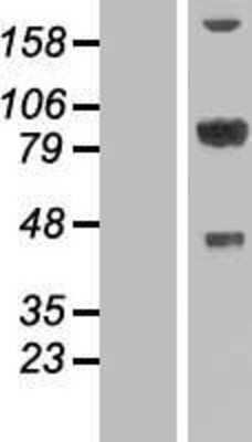 Western Blot: PATZ Overexpression Lysate [NBP2-10329]