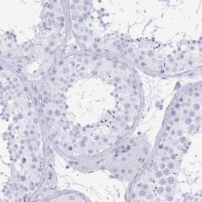 Immunohistochemistry-Paraffin: PAUF/ZG16B Antibody [NBP1-81699]