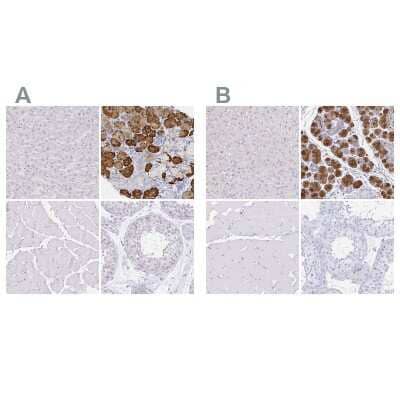 Immunohistochemistry-Paraffin: PAUF/ZG16B Antibody [NBP2-49089]