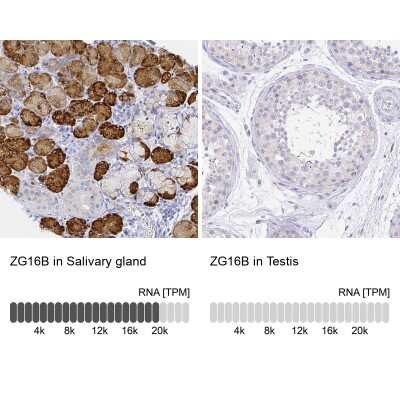 Immunohistochemistry-Paraffin: PAUF/ZG16B Antibody [NBP2-49089]